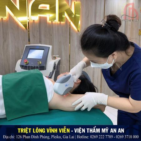 Địa chỉ Triệt Lông Hiệu quả - Nhanh chóng tại Gia Lai