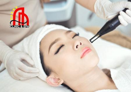 Laser Toning – Giải pháp công nghệ tiên tiến trong điều trị thẩm mỹ