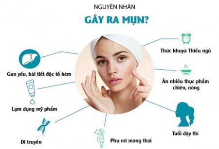 Tại sao bạn lại Thất Bại trong việc Điều Trị Mụn?